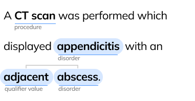 Uncertainty Detection example